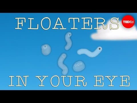 眼睛有蟲在飄？！那些黑影到底是如何形成的！（What are those floaty things in your eye? - Michael Mauser）