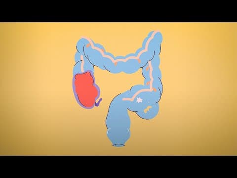 其實「每天都要排便」是錯誤的觀念？讓專家告訴你正常的排便頻率！(Why you shouldn't worry about pooping once a day | Body Stuff with Dr. Jen Gunter)